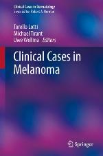 Clinical cases in melanoma