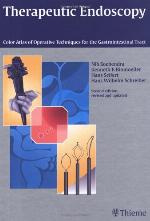 Therapeutic Endoscopy