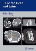 CT of the Head and Spine