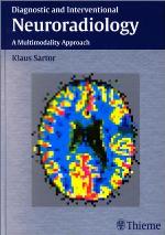 Diagnostic and Interventional Neuroradiology