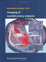 Imaging of Carotid Artery Stenosis