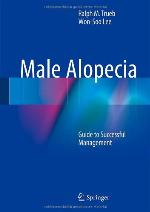 Male Alopecia