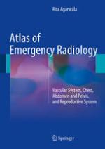 Atlas of Emergency Radiology : Vascular System, Chest, Abdomen and Pelvis, and Reproductive System