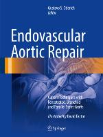 Endovascular Aortic Repair