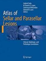 Atlas of Sellar and Parasellar Lesions
