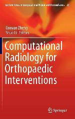 Computational Radiology for Orthopaedic Interventions