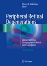 Peripheral Retinal Degenerations Optical Coherence Tomography and Retinal Laser Coagulation