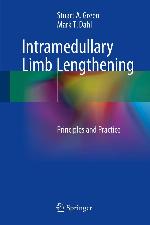 Intramedullary Limb Lengthening