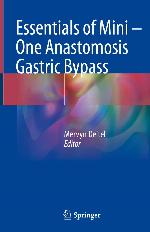 Essentials of Mini ‒ One Anastomosis Gastric Bypass