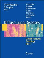 Diffusion-Weighted MR Imaging of the Brain