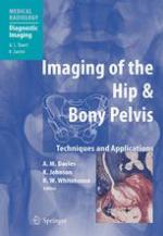 Imaging of the Hip &amp; Bony Pelvis