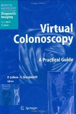 Virtual Colonoscopy