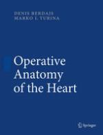 Operative Anatomy of the Heart