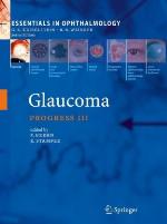 Glaucoma (Essentials in Ophthalmology)