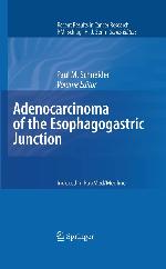 Recent Results in Cancer Research, Volume 182