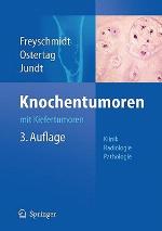 Knochentumoren Mit Kiefertumoren