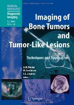 Imaging of Bone Tumors and Tumor-Like Lesions
