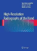 Highresolution Radiographs of the Hand