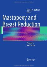Mastopexy and Breast Reduction