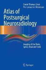 Atlas of Postsurgical Neuroradiology