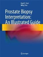 Prostate Biopsy Interpretation