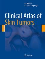 Clinical Atlas of Skin Tumors