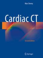 Cardiac CT
