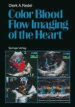 Color blood flow imaging of the heart