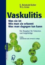 Vaskulitis