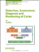 Detection, assessment, diagnosis and monitoring of caries
