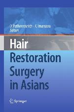 Hair Restoration Surgery in Asians