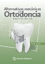 Alternativas mecánicas en ortodoncia : aplicación práctica