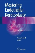 Mastering Endothelial Keratoplasty