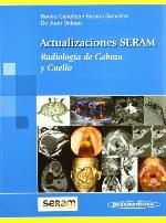 Radiología de cabeza y cuello : Actualizaciones SERAM.