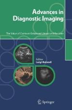 Advances in Diagnostic Imaging: The Value of Contrast-Enhanced Ultrasound for Liver