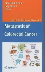 Metastasis of Colorectal Cancer