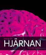 Hjärnan