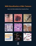 WHO Classification of Skin Tumours (Medicine)