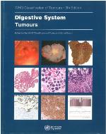 Digestive System Tumours