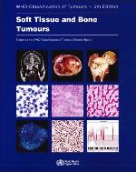 Soft Tissue and Bone Tumours (Medicine)