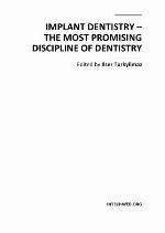 Implant Complications.