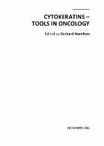 Cytokeratin 8 The Dominant Type Ii intermediate Filament Protein in Lung Cancer