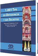 1001 Tips en Ortodoncia y sus secretos
