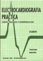 Electrocardiografia Practica
