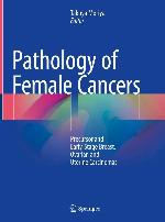Pathology of female cancers : precursor and early-stage breast, ovarian and uterine carcinomas